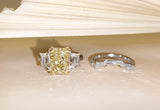 Matching Rings